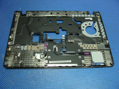Lenovo ThinkPad E450 14" Genuine Laptop Palmrest AP0TR000M00 - Laptop Parts - Buy Authentic Computer Parts - Top Seller Ebay