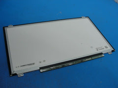 Dell Inspiron 15.6" 15 5567 LG Display Glossy HD LCD Screen NT156WHU(TP)(A1) - Laptop Parts - Buy Authentic Computer Parts - Top Seller Ebay